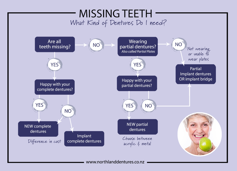 dentures-flowchart