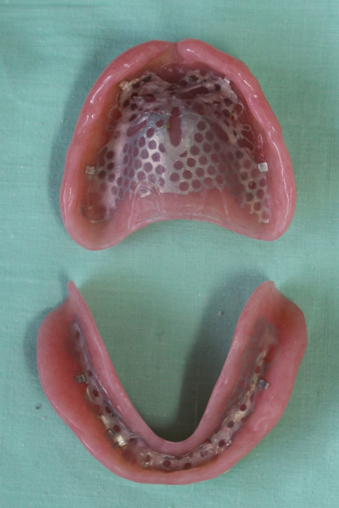 Complete Dentures Northland Prosthodontics Northland Denture