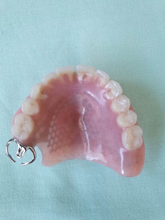 Partial Dentures (plates)